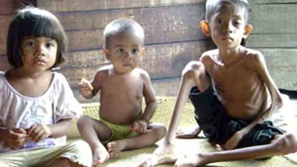 Ahok: Gizi Buruk di Jakarta Terjadi Karena TBC atau HIV