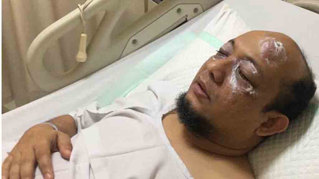 KPK Minta Polisi Gerak Cepat Ungkap Pelaku Penyiraman Air Keras ke Novel Baswedan