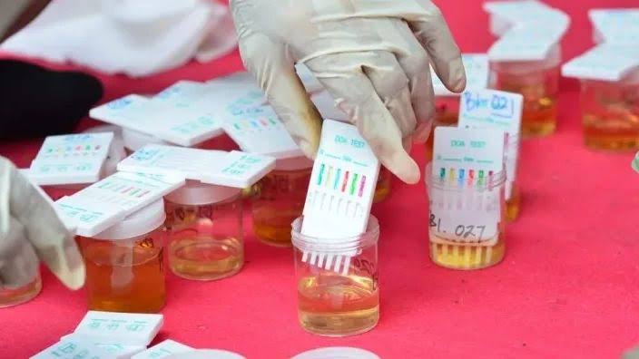 Ratusan Personil di Polda Metro Jaya Tes Urine, Begini Hasilnya