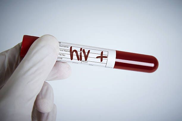 ilustrasi HIV