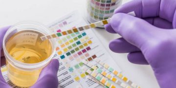 9 Warna Urine dan Tanda Ancaman Bahaya Bagi Kesehatan