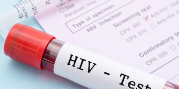 Papua Masih Jadi Daerah dengan Prevalensi HIV Tertinggi di Indonesia