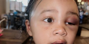 Anak Selebgram Aghnia Punjabi, Disiksa oleh Perawat yang Dikira Polos dan Lugu