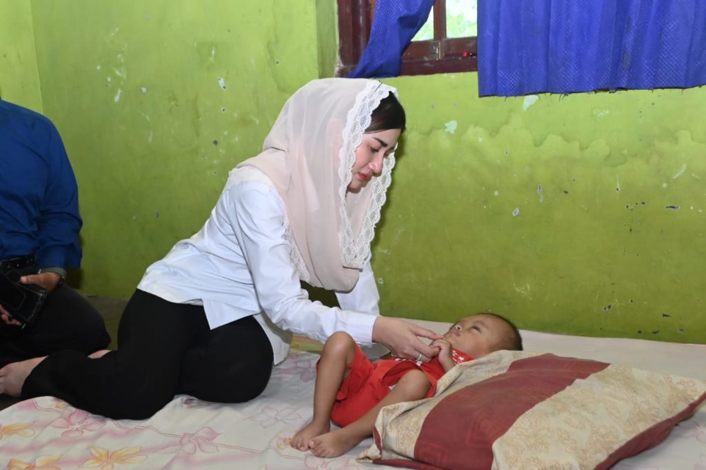 Novita Hardini saat temui balita penderita hidrosefalus