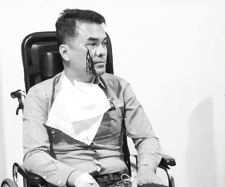 Wakil Ketua Umum (Waketum) PSI, Ronald A. Sinaga atau Bro Ron, usai dipukul dua pria di Menteng, Jakarta Pusat (Dok IG Bro Ron)